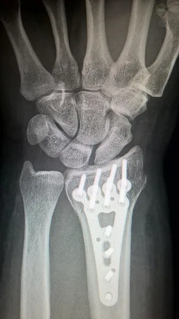 kaiser trauma therapy