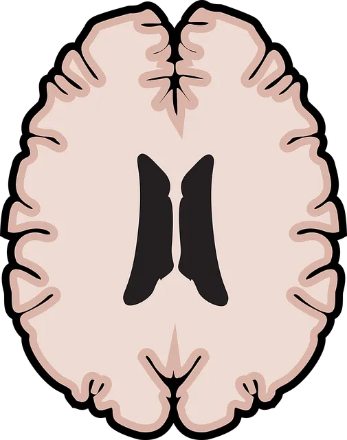 mental health