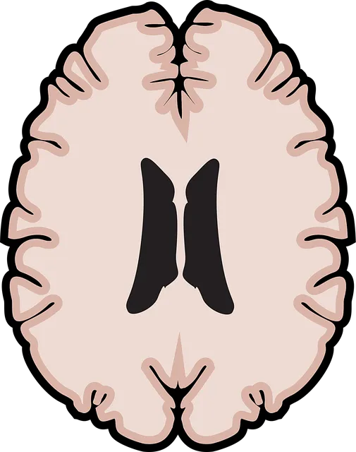 mental health