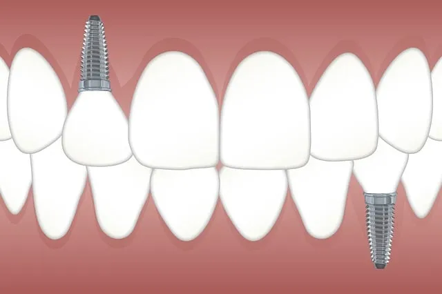 Modern Dental Tech: Efficient Treatments with Dr Kulick’s Innovations