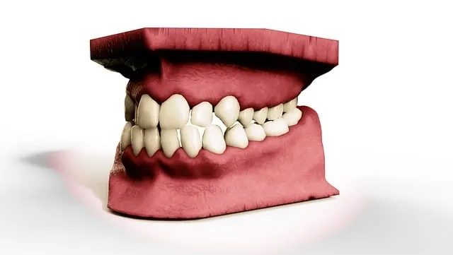 orthodontics mcallen tx