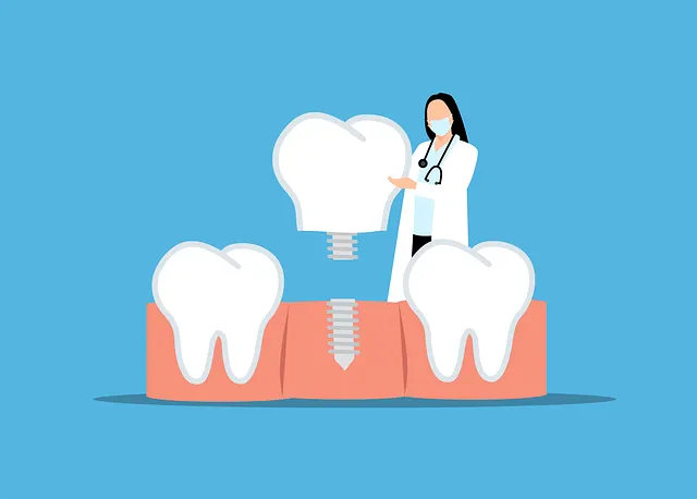 dental implants mcallen
