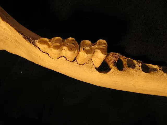 dentist-640x480-76009815.jpeg