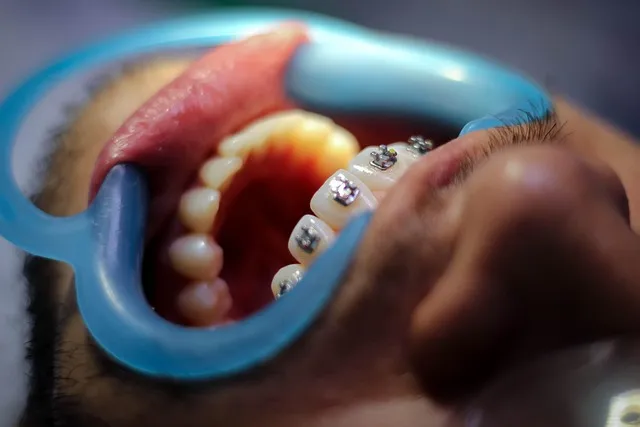 mcallen tx braces