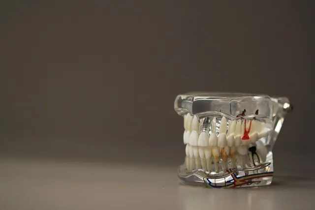 dental-implants-mcallen-640x480-49851805.jpeg