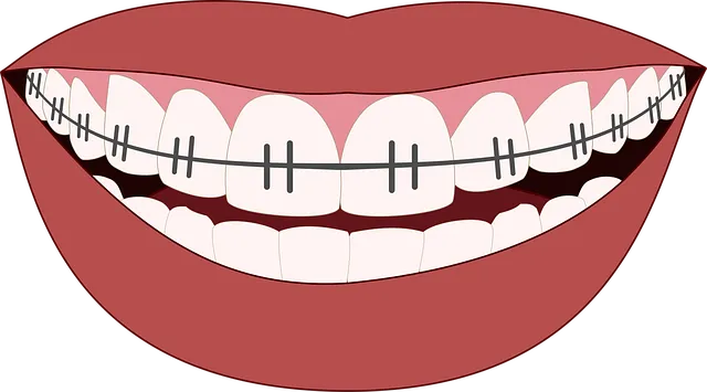 dental-implants-mcallen-tx-640x480-43372907.png