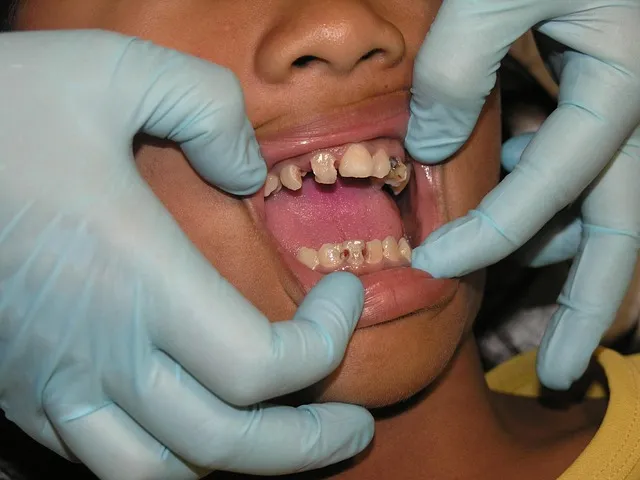 dental implants mcallen tx