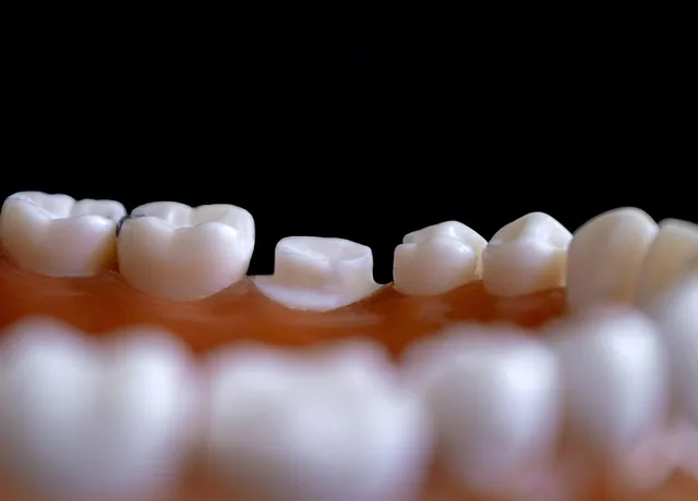dentist-640x480-33058311.jpeg