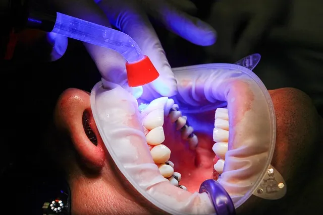 dentist-640x480-75085800.jpeg