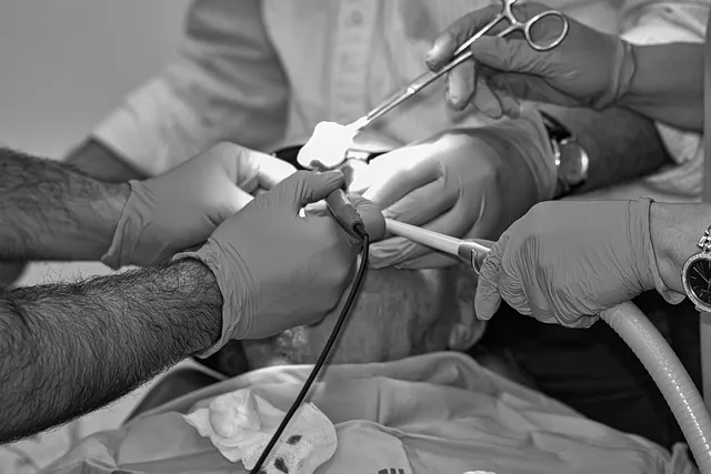 Prepare for McAllen Dental Implants: Expert Guide to Success