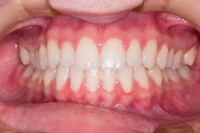 how-often-should-i-visit-a-mcallen-denti-640x480-63324309.jpeg