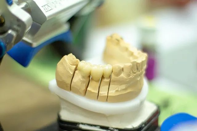 low cost dentist mcallen tx