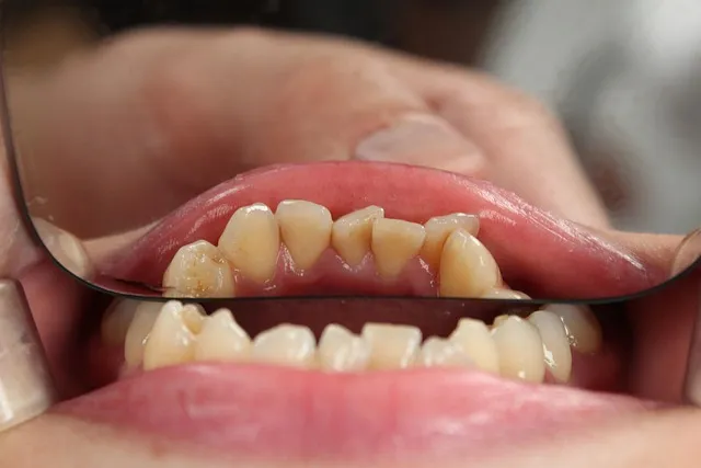 mcallen-dentist-640x480-36498566.jpeg