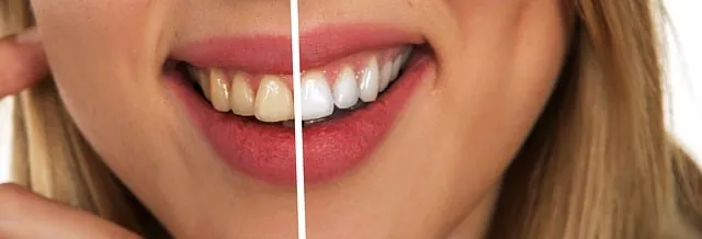 mcallen dentist