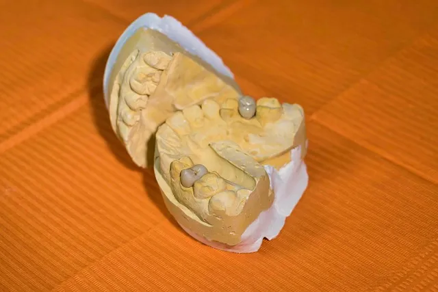 mcallen tx dentist