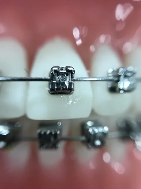 orthodontics mcallen tx