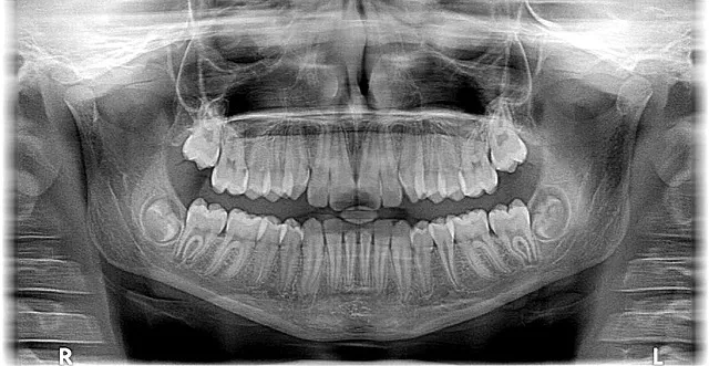 orthodontist mcallen