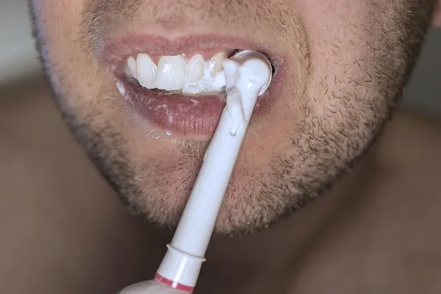 teeth whitening in mcallen tx