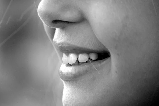 teeth whitening mcallen