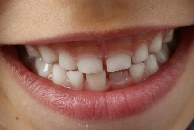top dental mcallen