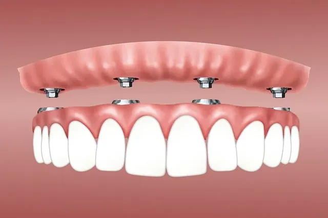 Boost Confidence: McAllen’s Top Cosmetic Dentistry Affordably