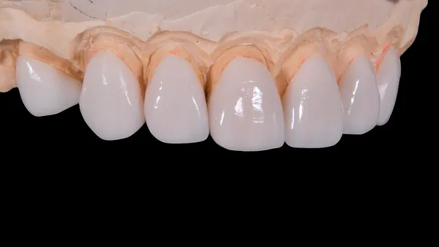 dental implants mcallen
