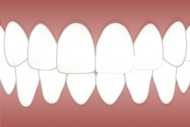 teeth whitening mcallen